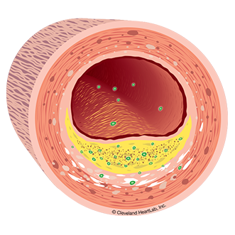 artery wall section 3